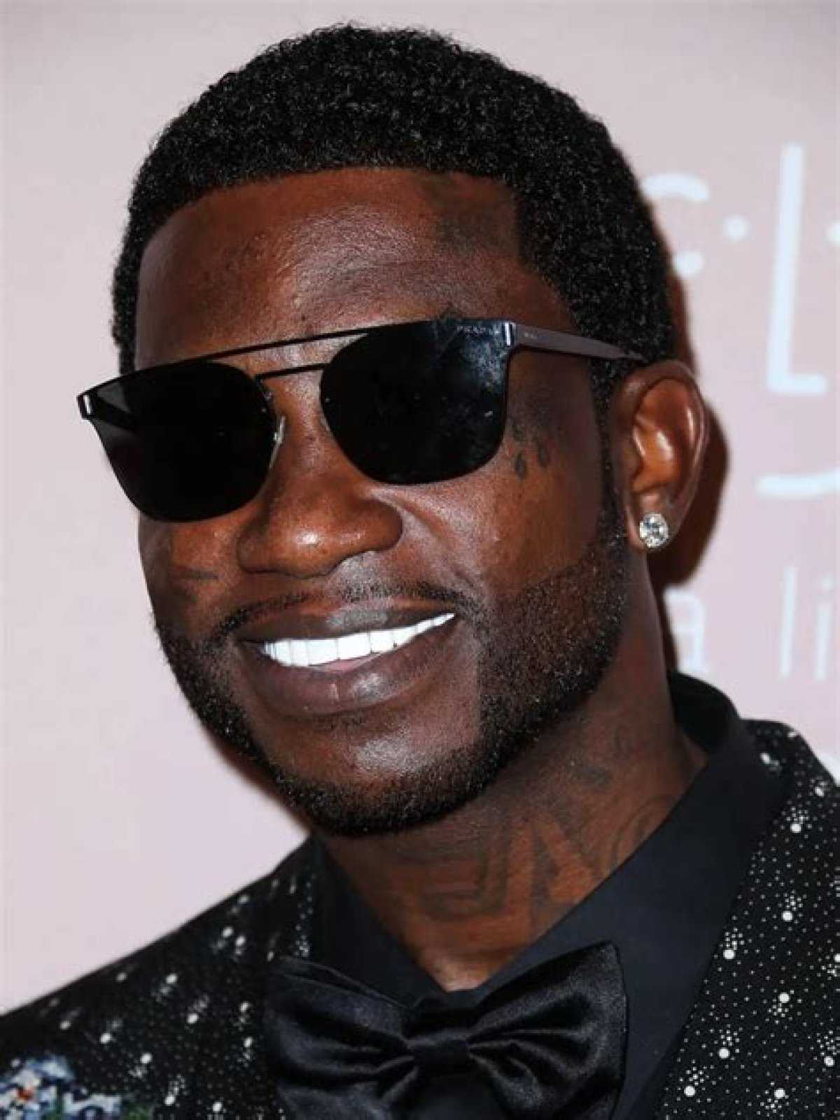 Did Gucci Mane get his teeth done?